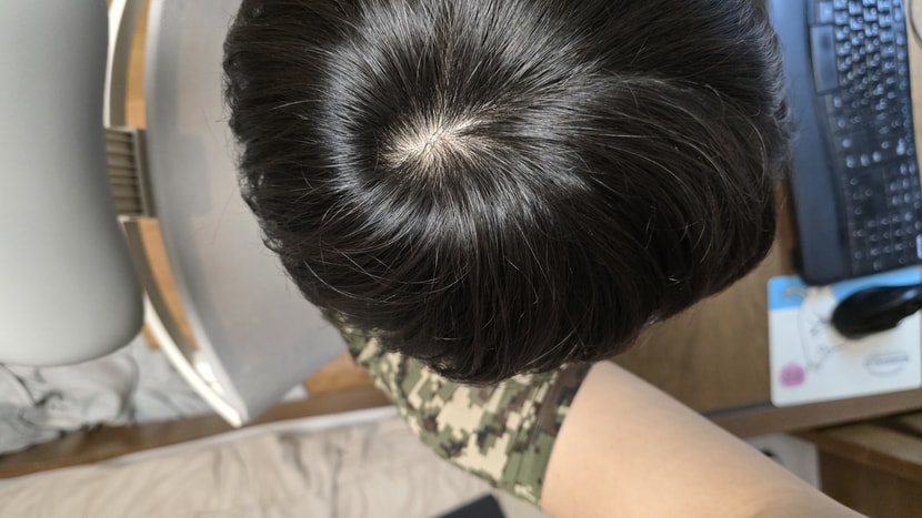 이틀전사진