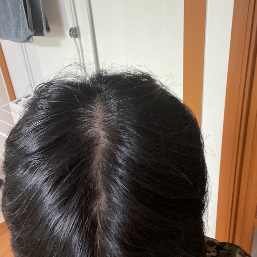 위에서 보면 명확하게 흰 줄이 그어져 있습니다..