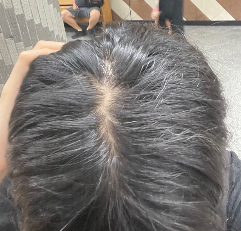정수리 1
