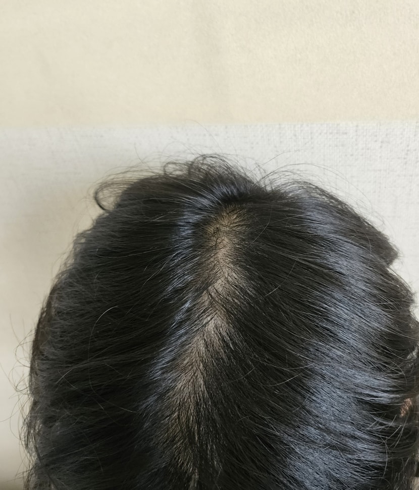 감은지 한시간지난 머리