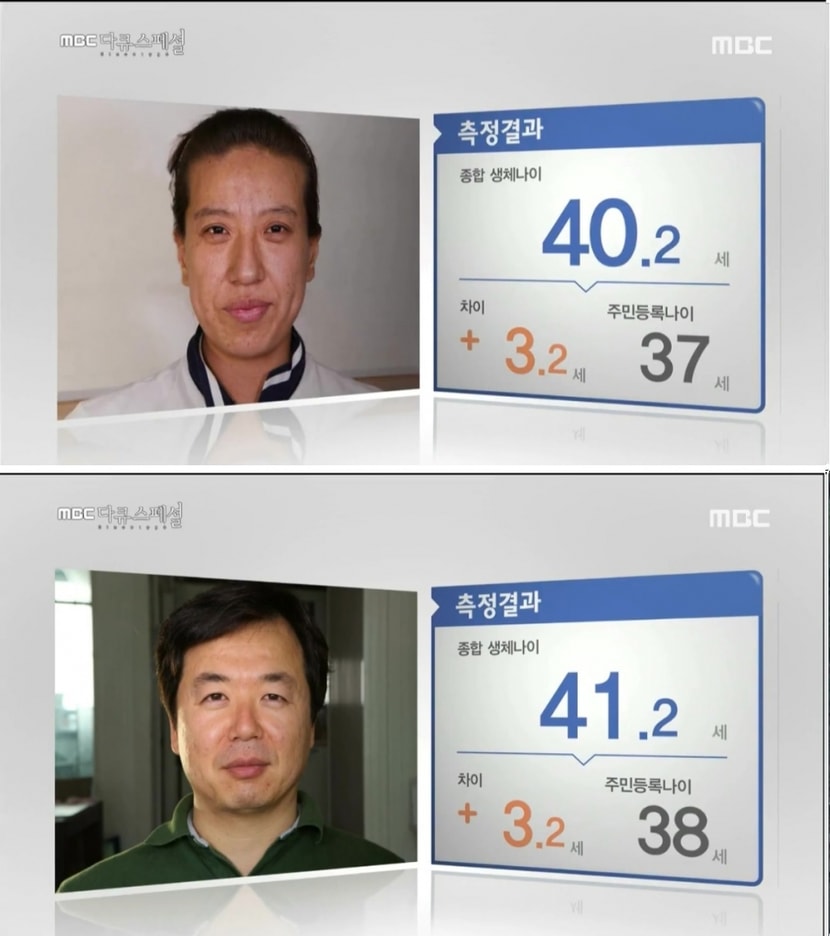 노안팀