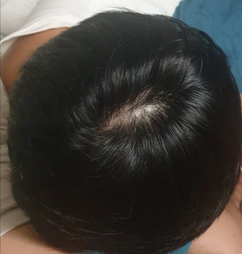 需要换药吗？