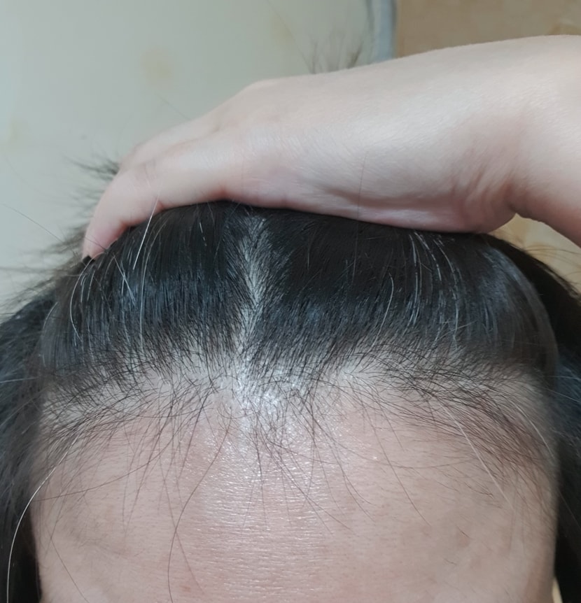 현재앞머리