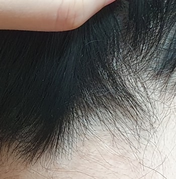 뒷머리