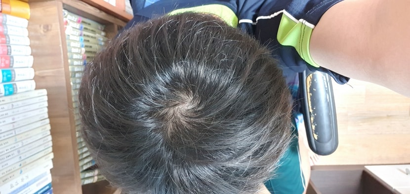 2개월차...