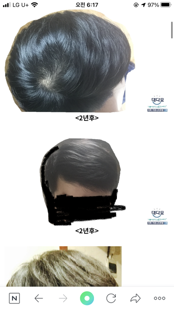 이게 이년후 사진