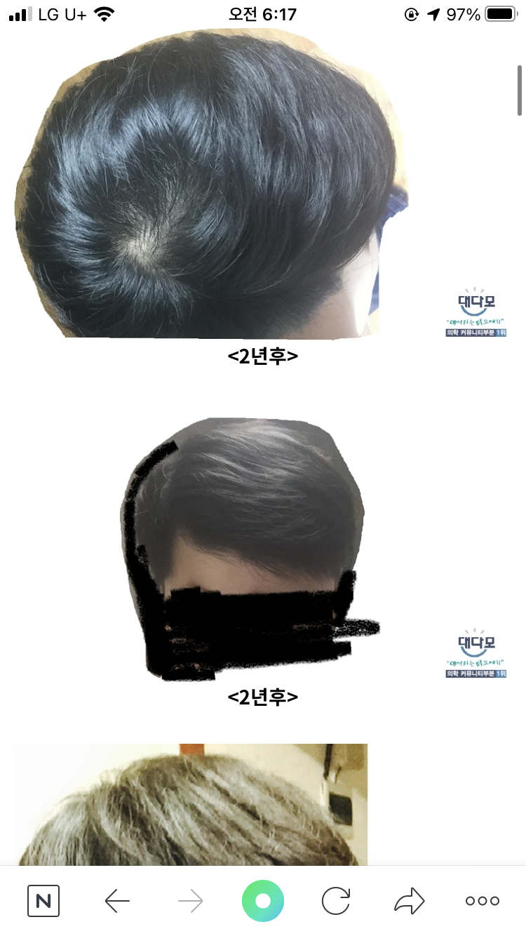 이게 이년후 사진 