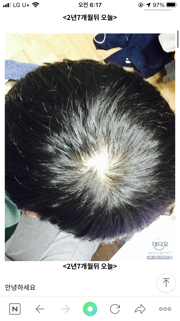 이건 2년7개월 된 사진 이사진은 빛이 너무 쌔기 때문에 이해 부탁드립니다