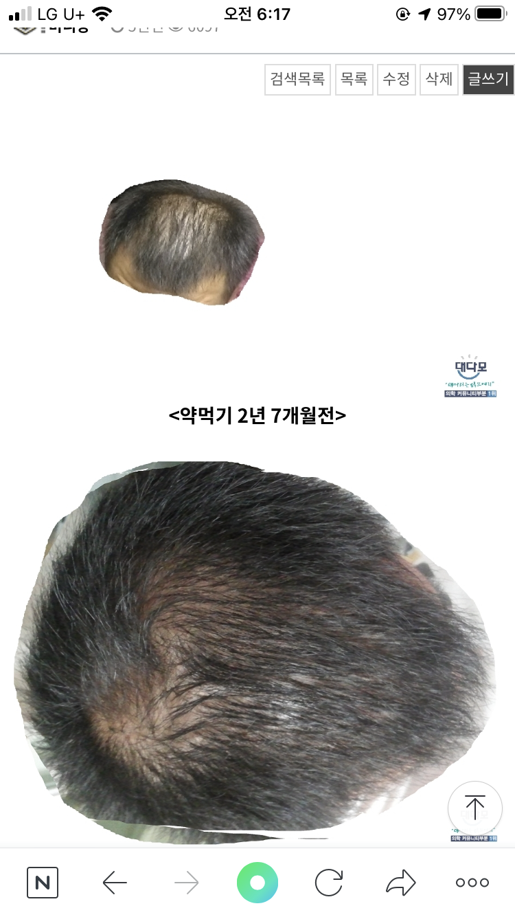 이게 9년전 사진이죠 아이디 검색 하면 나옵니다