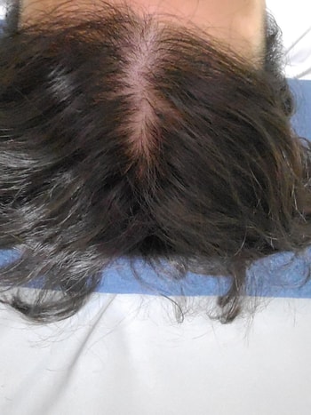 2021.04.10 : 파괴와 재생의 전쟁