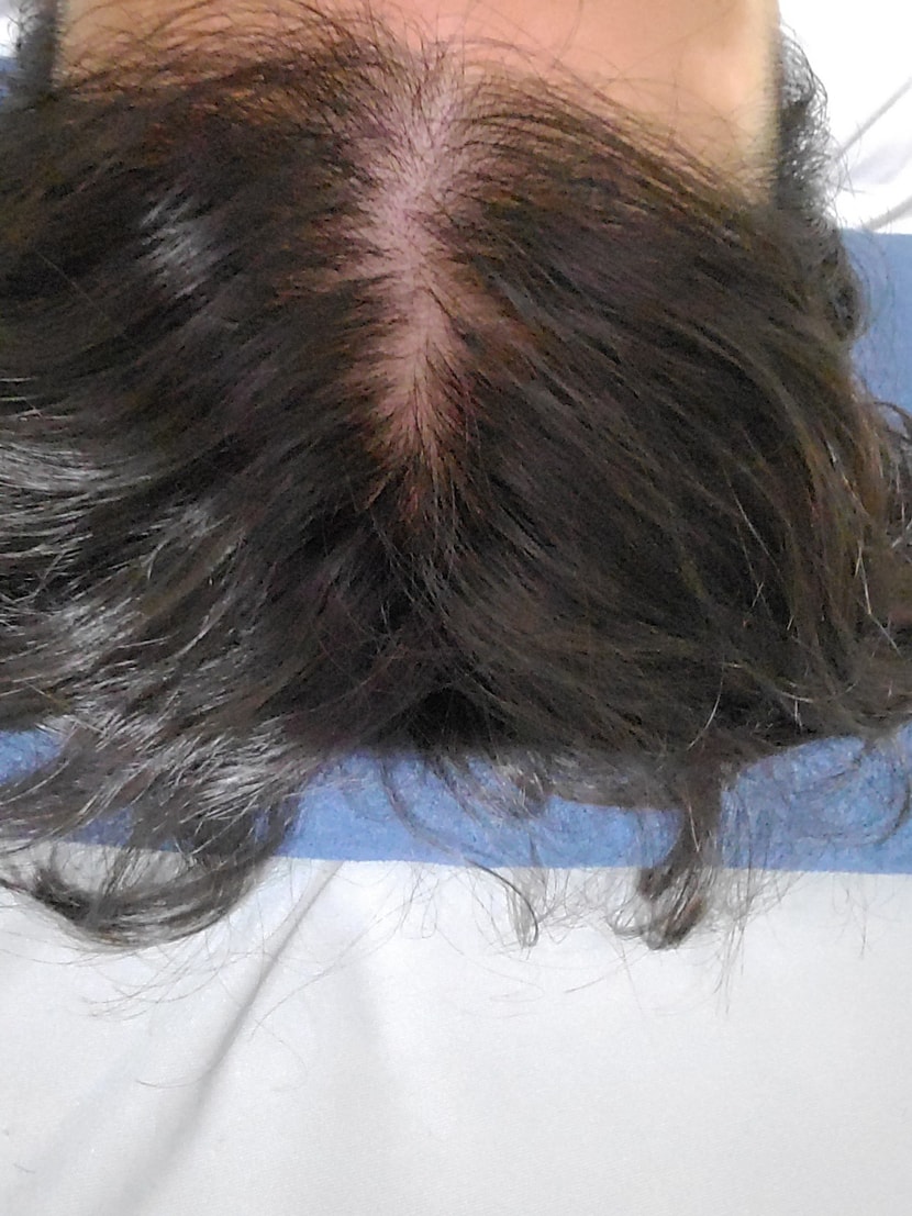 2021.04.10 : 파괴와 재생의 전쟁