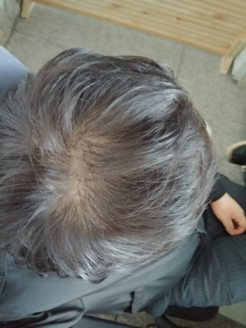 방심이 낳은 결과