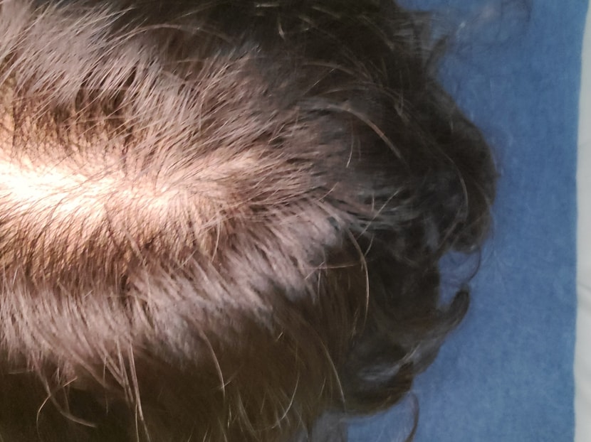 2020.05.22 : 5알파의 재공격