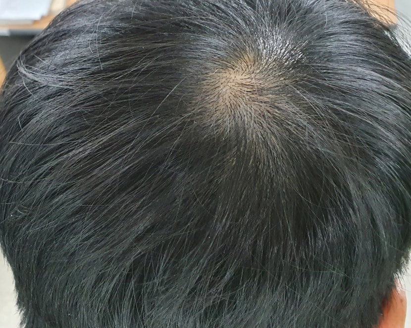 정수리 사진5