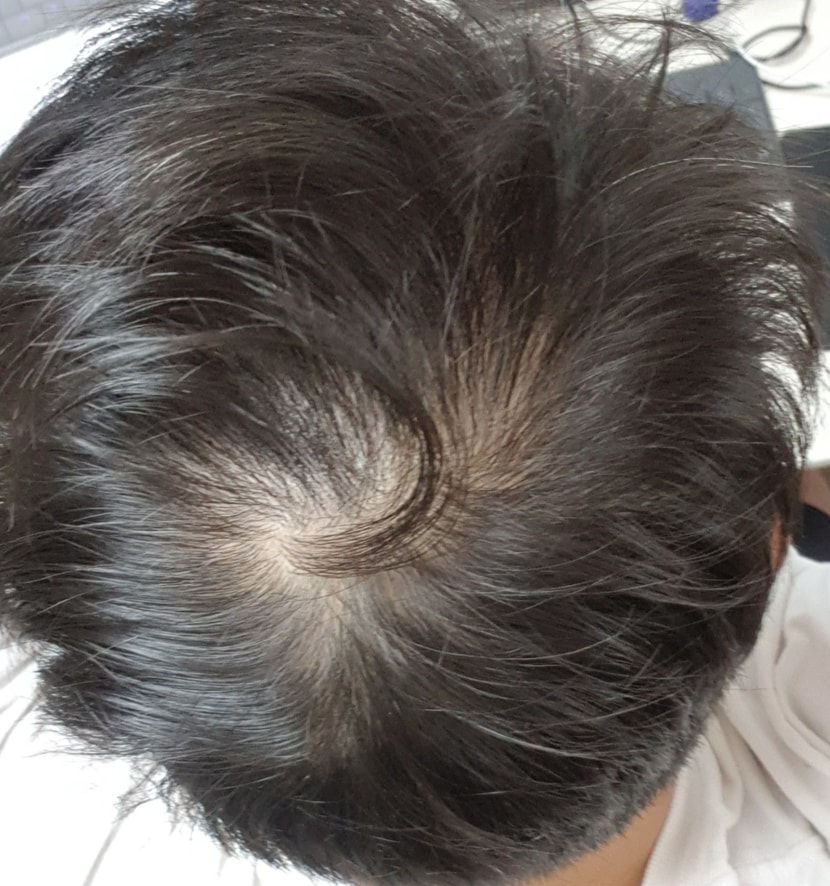 정수리