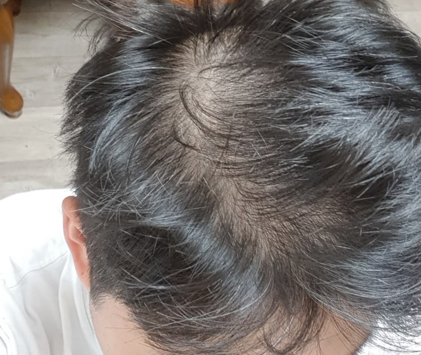 옆라인