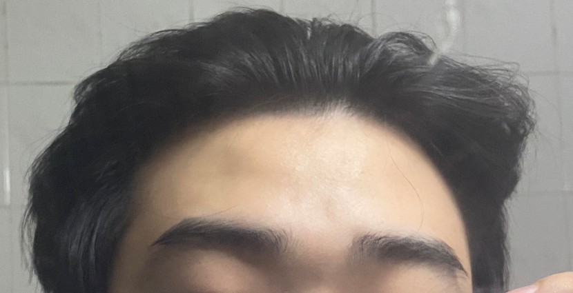 탈모인강