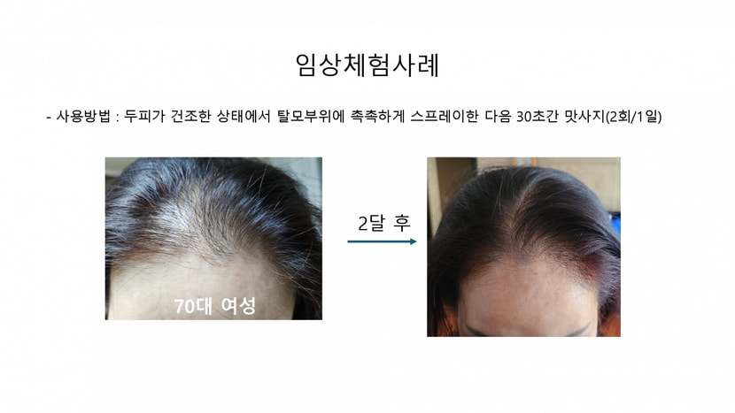 인체사용사례