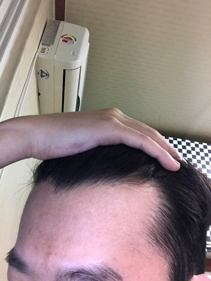 좌측