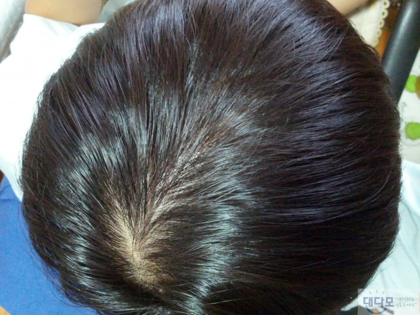 피나 230일차