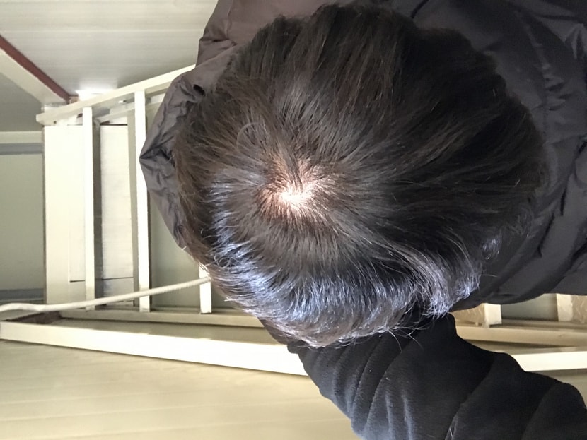 현재 머리상황입니다 