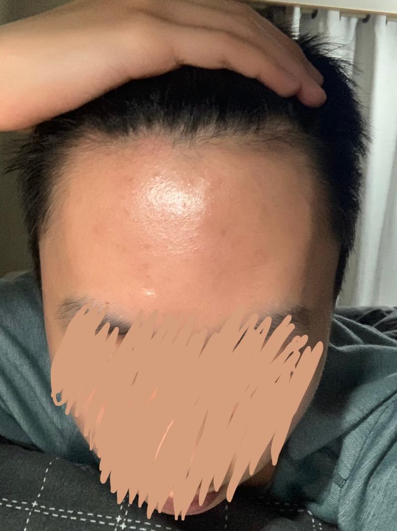 몇 모 정도 심어야할까요??