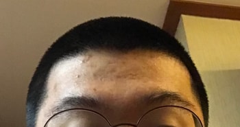 17세