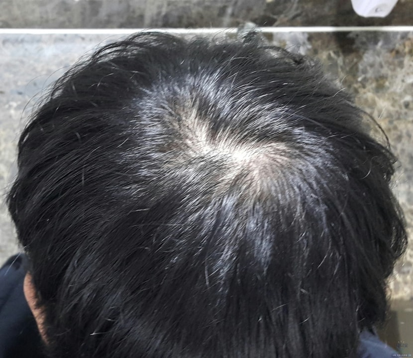 입대전