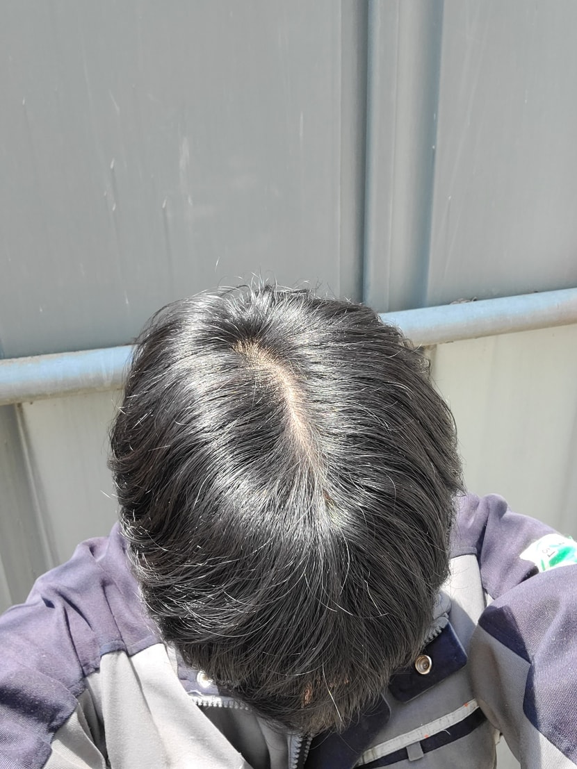 햇빛 아래1