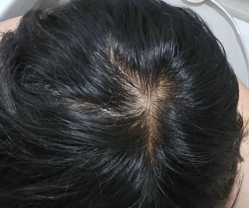 [Inquiry] 7th year of Pina / Thinking about changing ungreen tablet + avodat