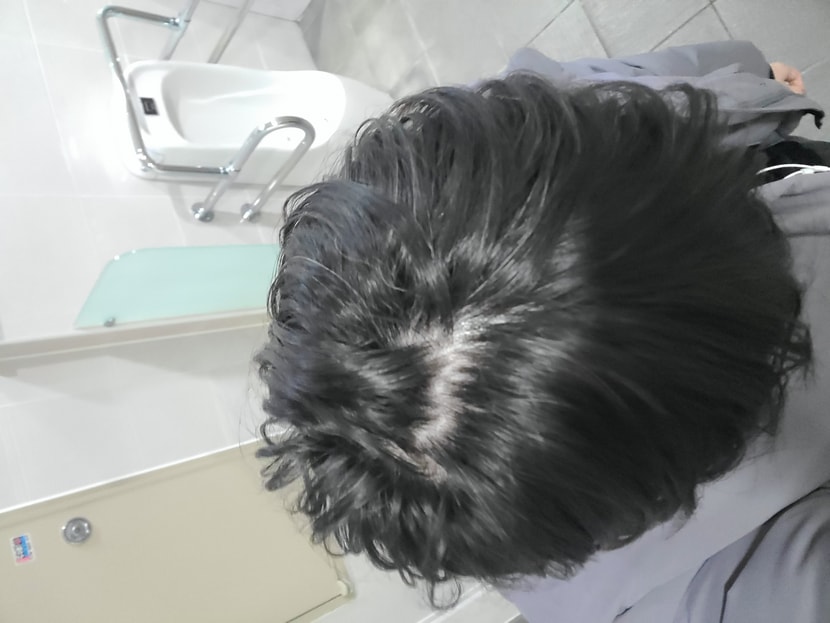 피나 복용중일때