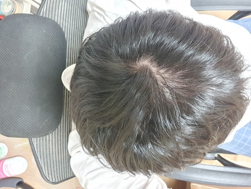 완전 빛 세게 받았을 때