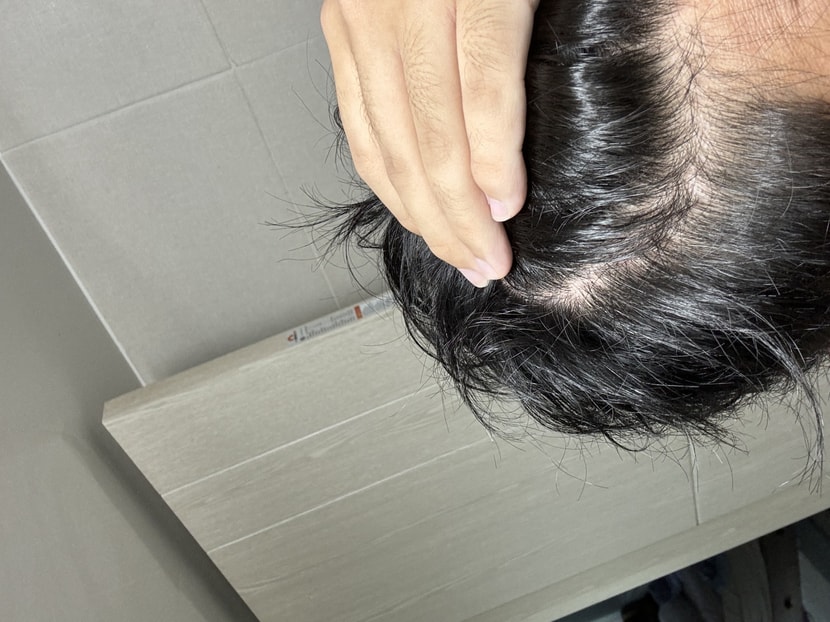 머리 감은 후 오른쪽머리(2)