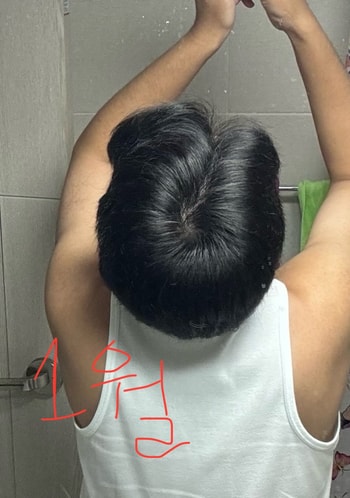 1월에 찍은 사진.. 정상적으로 보이네요..