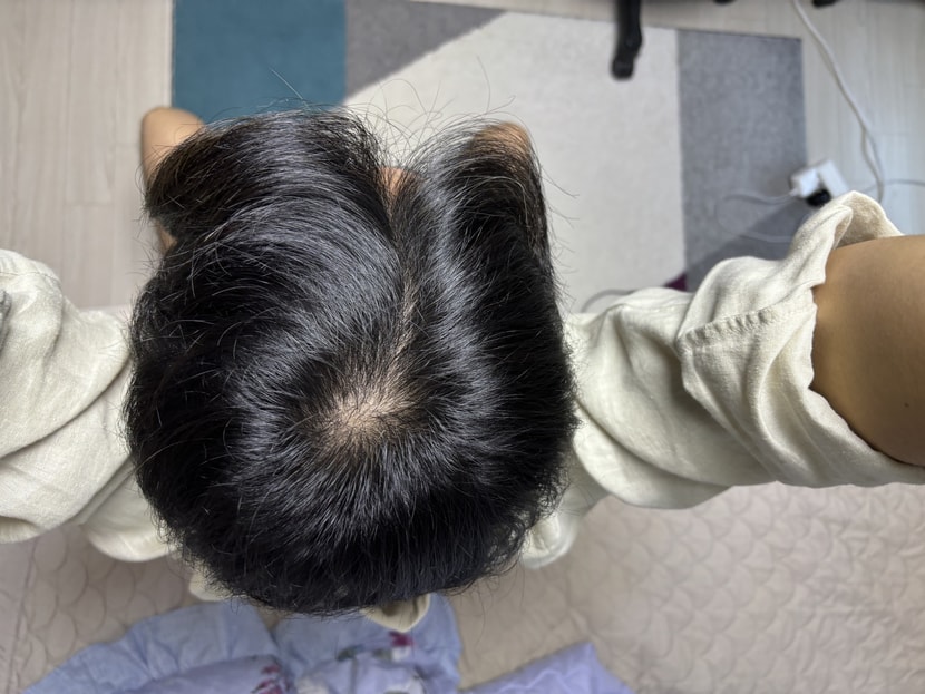 빛 아래에서 정수리