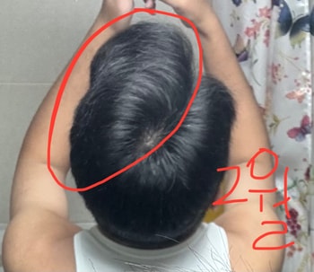 2월에 찍은 사진 동그라미 친 부분이 뭔가 질감이 이상해보입니다..