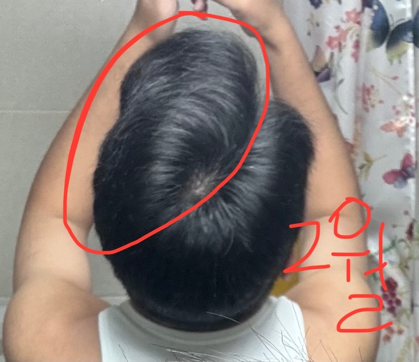 2월에 찍은 사진 동그라미 친 부분이 뭔가 질감이 이상해보입니다..