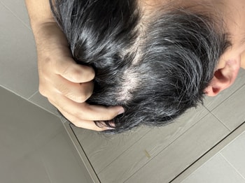 머리 감기 전 오른쪽머리(2)