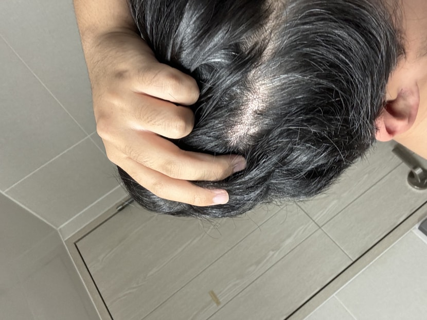 머리 감기 전 오른쪽머리(1)
