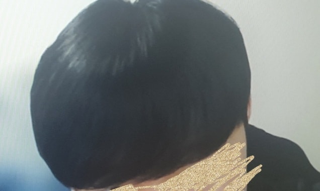 3个月之后头发就碎了...