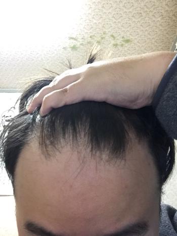 정면