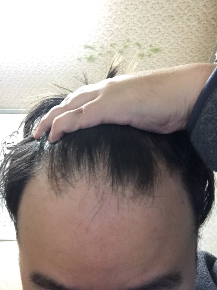 정면