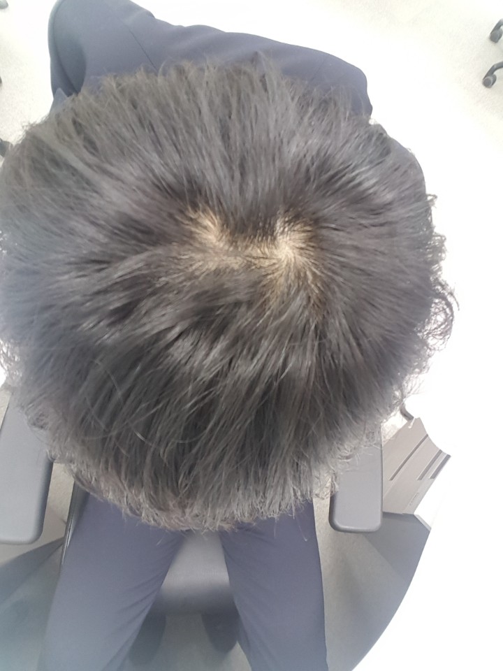 17년 6월 28일 그냥가만히 놔두면