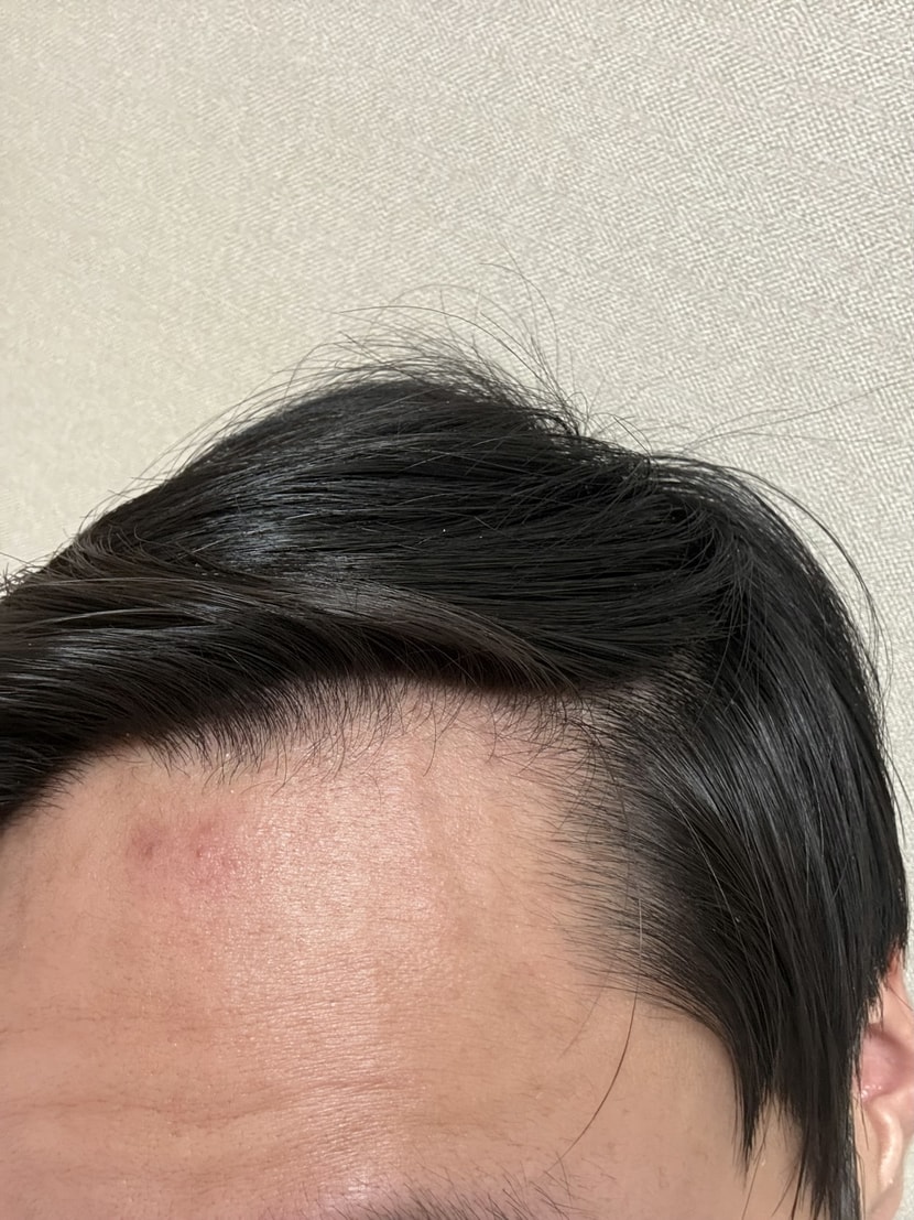 오른쪽 m자