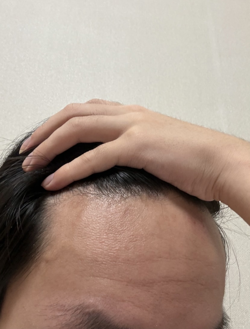 왼쪽 m자