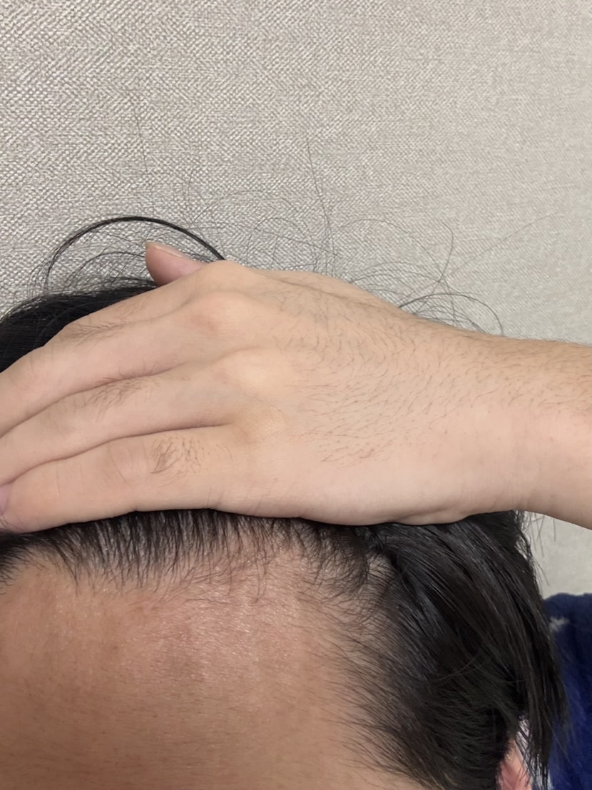 오른쪽 m자