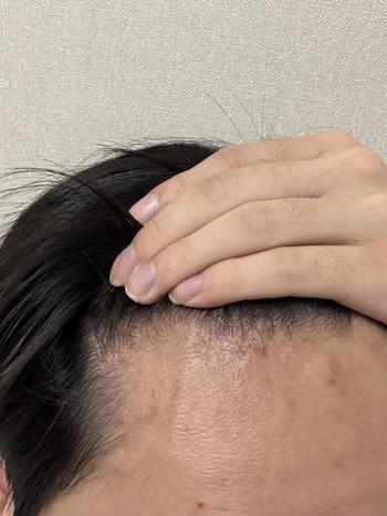 왼쪽 m자