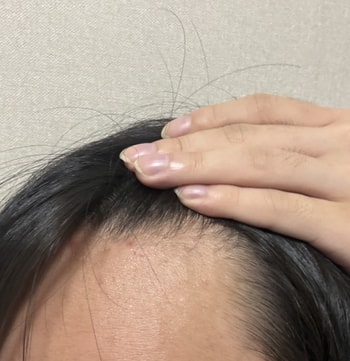 오른쪽 m자