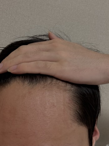 오른쪽 m자