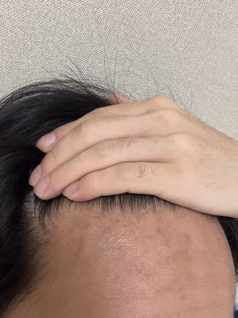 왼쪽 m자